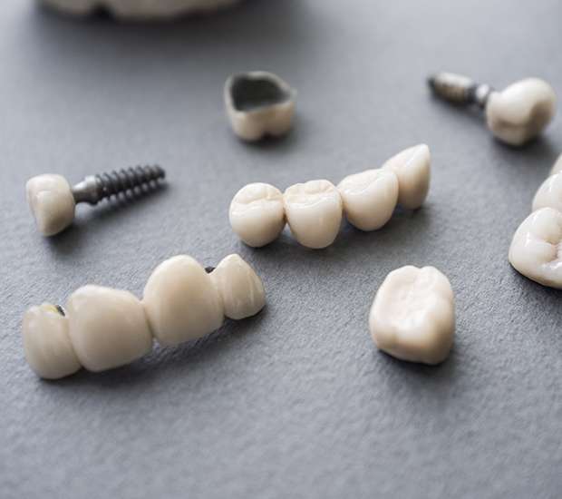 Berkley The Difference Between Dental Implants and Mini Dental Implants