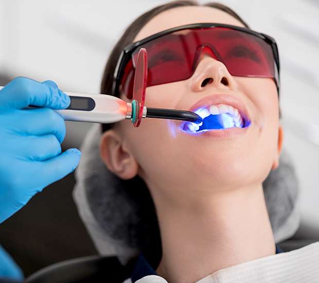 Berkley Professional Teeth Whitening